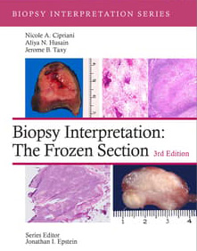 Cover image for Biopsy Interpretation the Frozen Section